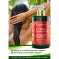 thumbnail image 5 of Botanical Hair Growth Cayenne Shampoo with Saw Palmetto for Hair Loss and Hair Thinning Prevention Scalp Detoxifying Natural Thickening Shampoo For Hair Regrowth 10.2 Fl Oz, 5 of 9