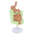 thumbnail image 1 of Xingzhi Human Gastrointestinal Pathology Model Anatomy Study, 1 of 8