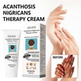 thumbnail image 2 of 3pcs Acanthosis Cream Nigrifix Cream For Acanthosis Nigricans Black Spot, 2 of 5