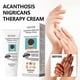 thumbnail image 2 of 3pcs Acanthosis Cream Nigrifix Cream For Acanthosis Nigricans Black Spot, 2 of 5