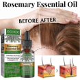 thumbnail image 3 of Rosemary Hair Oil For Hair Growth, Essential Oil, Strengthens Hair, Nourishes Scalp, Premium Therapeutic Grade With Dropper, 3 of 5