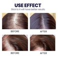thumbnail image 4 of Japanese Hair Growth Spray 50ml, 4 of 6