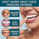 thumbnail image 4 of Denture Teeth Temporary Fake Teeth For Snap On Instant Confidence Smile, Dental Veneers For Temporary Teeth Restorationa6, 4 of 5