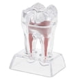 thumbnail image 1 of Soidarity Estudio Enseñanza Base de cristal de plástico duro Modelo molar de diente para análisis preciso cuidado de los oídos, 1 of 1