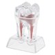thumbnail image 1 of Seitruly Estudio Enseñanza Base de cristal de plástico duro Modelo molar de diente para análisis preciso cuidado de los oídos, 1 of 1