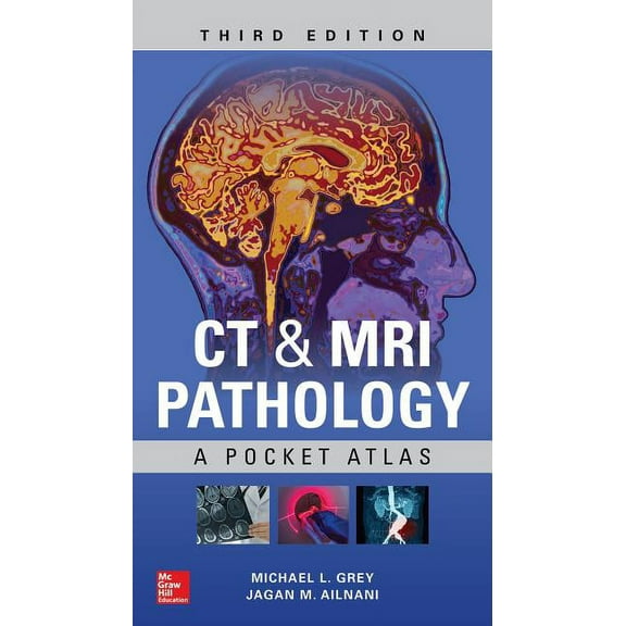 CT & MRI Pathology: A Pocket Atlas, Third Edition (Paperback)