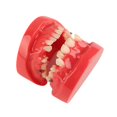 thumbnail image 1 of Dental Typodont Orthodontic Teeth Model Teaching Tool 24 Teeth Resin Dental Demonstration Study Model, 1 of 5