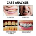 thumbnail image 2 of EELHOE floss teeth oral cleaning teeth pick disposable household portable denta, 2 of 4