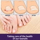 thumbnail image 5 of Parche corrector de uñas de los pies, pegatinas elásticas de corrección de uñas encarnadas, herramientas de pedicura, 5 of 10