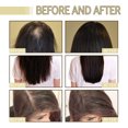 thumbnail image 3 of 2 Pcs Huile Essentielle Cheveux Denses au Romarin, Prévient la Perte de Cheveux, Répare les Frisottis et Cheveux Secs Huile Essentielle Cheveux Denses, 3 of 5