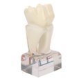 thumbnail image 3 of Modelo de nervio Dental profesional, modelo de dientes de demostración para estudio de enseñanza Dental, 3 of 5