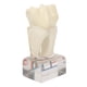 thumbnail image 1 of Modelo de nervio dental BuyWeek didáctico profesional, 1 of 14