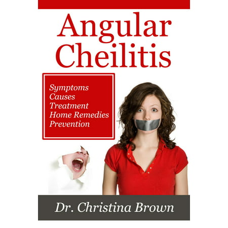 Angular Cheilitis - eBook