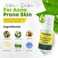 thumbnail image 5 of Luminus Ultra Tea Tree Acne Serum, with Witch Hazel, High Strength 50ml, 5 of 8
