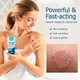 thumbnail image 3 of Roycederm Tinea Versicolor Treatment, Athletes Foot Treatment, Ringworm Treatment for Humans, for Tinea Versicolor & Pedis,Fast Healing Anti Fungal Skin Cream, 3 of 8
