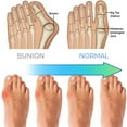 thumbnail image 3 of Orthopedic Summer Sandals Womens Comfortable Dressy Arch Support Orthopedic Toe Ring Slip On Slip Slippers, 3 of 5
