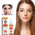 thumbnail image 1 of Sérum Facial de Frutos Rojos | Mezcla de ácido hialurónico y aceite nutritivo - Crema hidratante antienvejecimiento de noche y de día | Hidrata, repara, reduce las arrugas, las líneas finas, las, 1 of 8