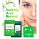 thumbnail image 3 of Tea Tree Acne Pimple Patch Pimple Removal Sticker Parche Para El Cuidado De La Piel ANGGREK AE1013, 3 of 8