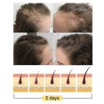 thumbnail image 3 of Jaysuing Ginger Thick Hair Shampoo Soap Moisturizing Hair Roots Deep Cleaning Scalp Hair Care Shampoo Soap Shampoo & Conditioner 1pcs |, 3 of 4