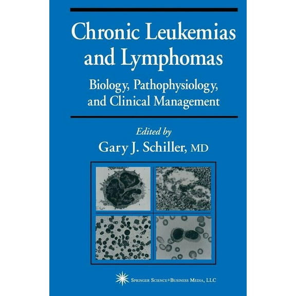 Current Clinical Oncology Chronic Leukemias and Lymphomas: Biology, Pathophysiology, and Clinical Management, (Paperback)