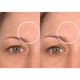 thumbnail image 5 of Parches antiarrugas SiO Beauty Facelift para rostro y cuello, 5 of 9