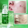 thumbnail image 2 of Sérum de tratamiento del acné HUOGUO Tea Tree 30 ml para marcas de acné, 2 of 4