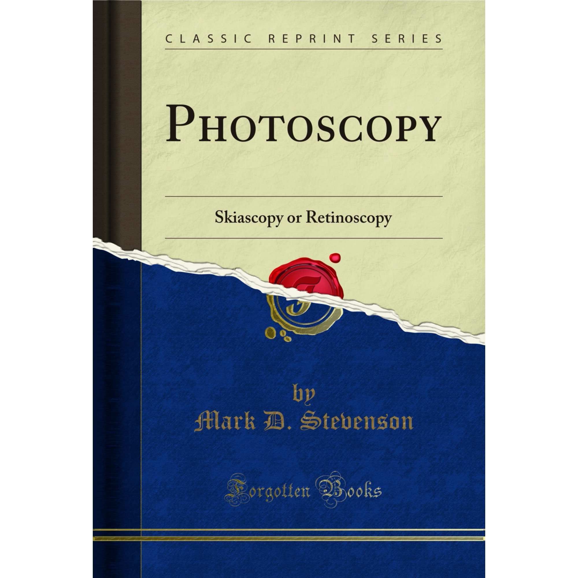 Photoscopy: Skiascopy or Retinoscopy (Classic Reprint)