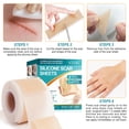 thumbnail image 5 of Silicone Scar Sheets Roll - Helps Support Scar Appearance for Old & New Scars, Cut-to-Size (1.6" x 150"), 5 of 10