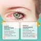 thumbnail image 3 of Adult Teen Eye-Vision Enhance Roller Reduces Fatigue Eyes Care Roller for Relieves Tired Dry Eyes 10ml, 3 of 5