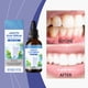 thumbnail image 3 of Suero bucal Essence con sabor a menta, refresca el aliento y suaviza las encías. Cuidado bucal+ 60 ml., 3 of 9