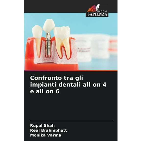 Confronto tra gli impianti dentali all on 4 e all on 6, (Paperback)