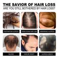 thumbnail image 5 of Jaysuing Of Garlic Shampoo Hair Itchy Anti-itching Anti-dandruff Shampoo Hair Growth Anti-fall Hair Growth, 5 of 5