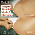 thumbnail image 6 of Besque Magic Body Oil – Unscented | Fragrance-Free | Hydrating & Firming Body Moisturizer| Natural Plant-Based Ingredients | Lightweight, Non-Greasy, Vegan Skincare | 3.4 FL Oz Pack of 1, 6 of 7