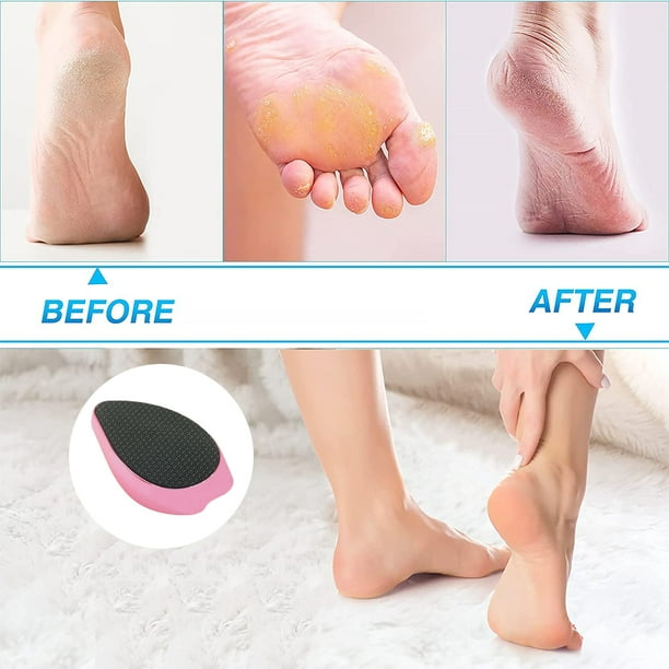 Innovative Nano Crystal Feet Scrubber, Portable Pedicure Foot Scraper For Dead  Skin Removal,suitable For Wet And Dry Safe Healthy Portable