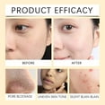 thumbnail image 3 of Vitamin C & Turmeric Clay Face Mask, Vitamin C Face Mask with Clay and Turmeric for Dark Spots, Turmeric Clay Mask, Cleansing Moisturising Skin Care Mask for Dark Spots, Blackheads, Pores,, 3 of 7