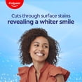 thumbnail image 4 of Colgate Baking Soda and Peroxide Whitening Toothpaste, Brisk Mint, 3 Pack, 6 oz, 4 of 17