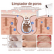 thumbnail image 3 of Extractor De Puntos Negros Recargable, 3 of 4