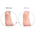 thumbnail image 3 of 4PCS Foot File Professional Double Sided Callus Remover Foot Rasp Pedicure Rasp, 3 of 10
