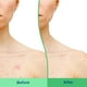 thumbnail image 5 of Exfoliante corporal Differin con ácido salicílico para eliminar el acné 240 ml, 5 of 9