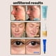 thumbnail image 4 of Set de cuidado de la piel Cocokind Hydration Heros Serum, crema para ojos e hidratante, 4 of 5