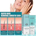 thumbnail image 2 of Lip Hair Removal Cream Hair Removal Cream For Face Fuzz Hair Remover Cream Upper Hair Removal Fuzz Remover For Facial 100g, 2 of 5