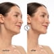 thumbnail image 3 of Mascarilla de Lifting Facial MAREE V Line con ADN de Salmón PDRN para Mujeres, 3 of 9