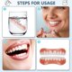 thumbnail image 5 of 2 Pairs False Teeth Veneers, Veneers Teeth Cosmetic Tooth Cover Fake Teeth Temporary Dentures Artificial Teeth Dentures, 5 of 5