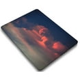 thumbnail image 1 of KSK KAISHEK Hard Protective Shell Case Cover Compatible with Old MacBook Pro 13"( No Touch, 2015/2014/2013/end 2012) + Black Keyboard Cover Model A1425 A1502, No USB-C / CD-ROM Pink series 0152, 1 of 5