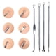 thumbnail image 5 of Kit De Herramientas Para Eliminar Espinillas, 4 Uds., Herramientas Para Eliminar Espinillas Y Espinillas Con Caja De Almacenamiento Advancent HA034927-00, 5 of 6