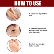 Tkrady Foot Corn Removal Extra Strengthen Gel, Liquid Corn and Callus Remover, Corn Remover Gel for Feet, Corn Removers for Toes Extra Strength 10ml