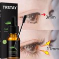 thumbnail image 1 of Suero líquido efectivo para el crecimiento de pestañas, producto potenciador de cejas, levantamiento de pestañas, alargamiento más completo, belleza más gruesa, cuidado de los ojos, 1 of 5