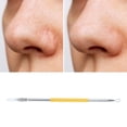 thumbnail image 5 of Unique Bargains 1 Pc Facial Double Headed Pimple Extractor Yellow, 5 of 7