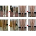 thumbnail image 4 of ZOUSSIQI 3pcs Leg Correction Belt, Stretchy Shaping Legs Posture Corrector for X Type Legs O Type Legs(L) CA919-50682, 4 of 8