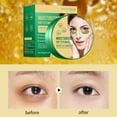 thumbnail image 4 of Yatlte Under Eye Patches, Eye Mask for Dark Circles, Puffy Eyes, Undereye Bags,Wrinkles,Eye Mask Patches, Hyaluronic Acid,Rose & Aloe Vera, Eye Treatment Skin Care for Men & Women Gift, 4 of 6